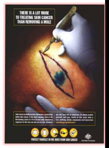 skin cancer from the sun ads.